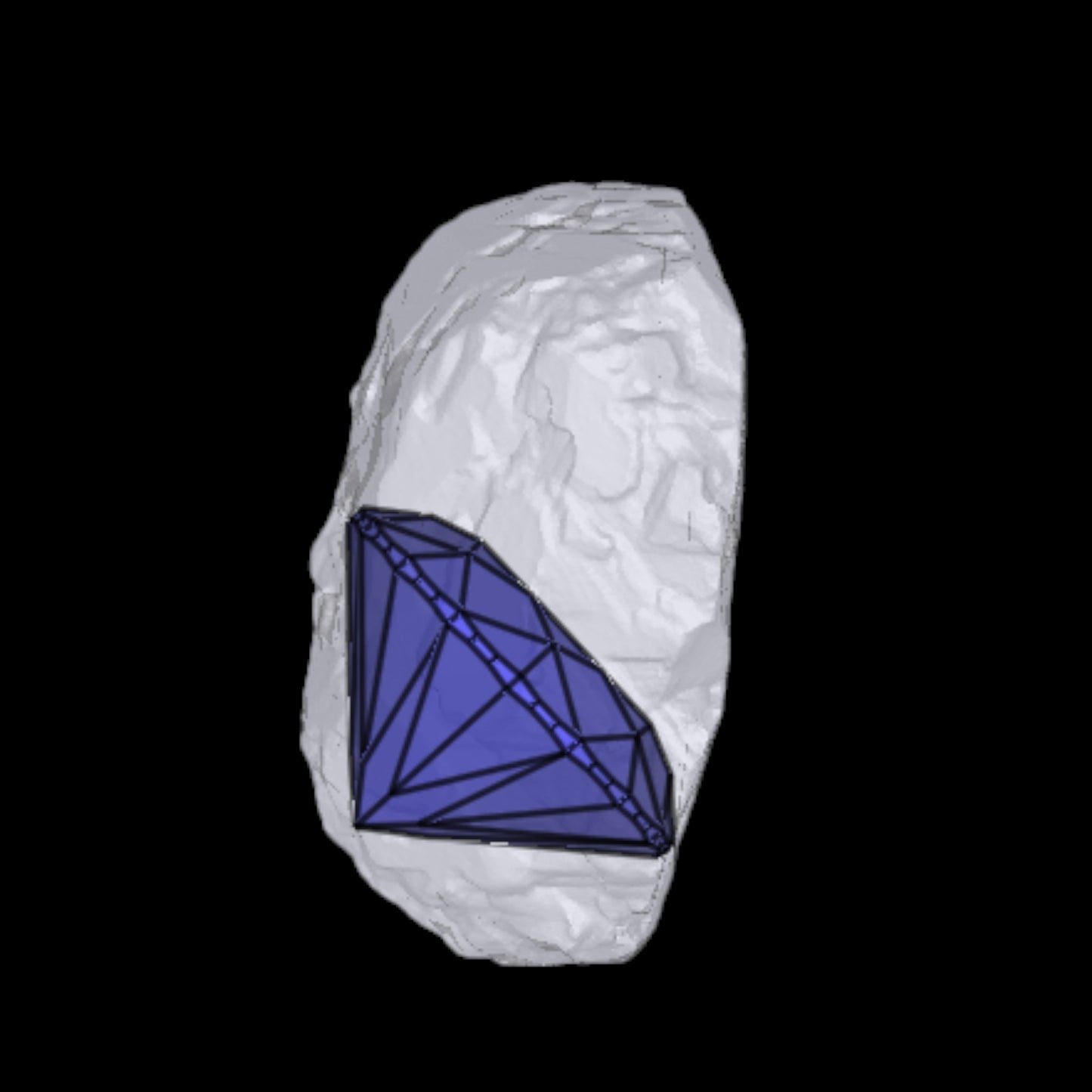 Seltener runder F VVS1 Diamant mit 5,02 Karat - Pure Eleganz aus Südafrika